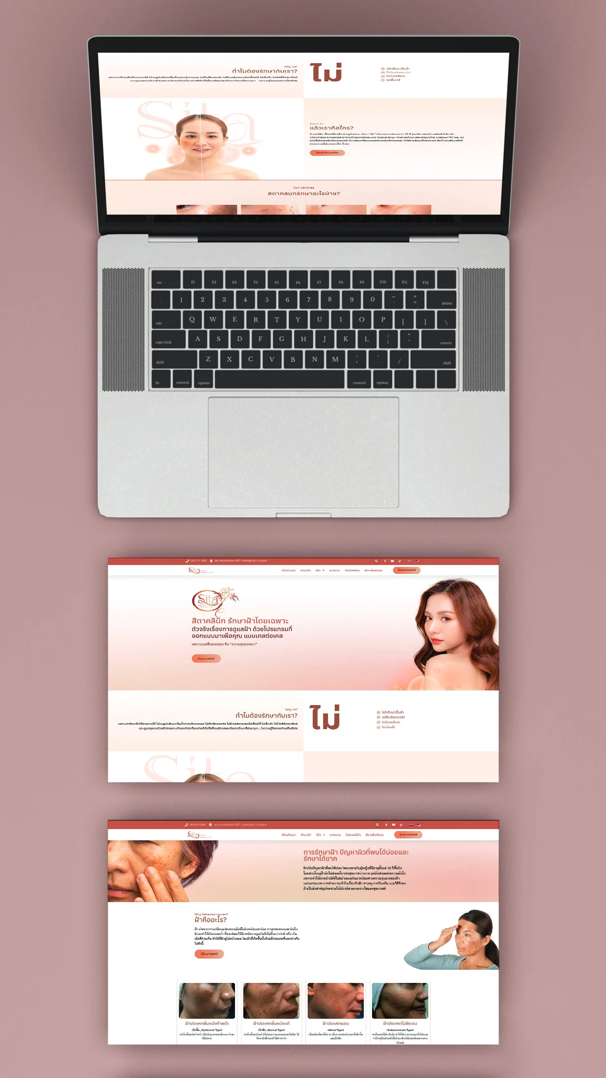 ออกแบบเว็บไซต์ Sita Clinic